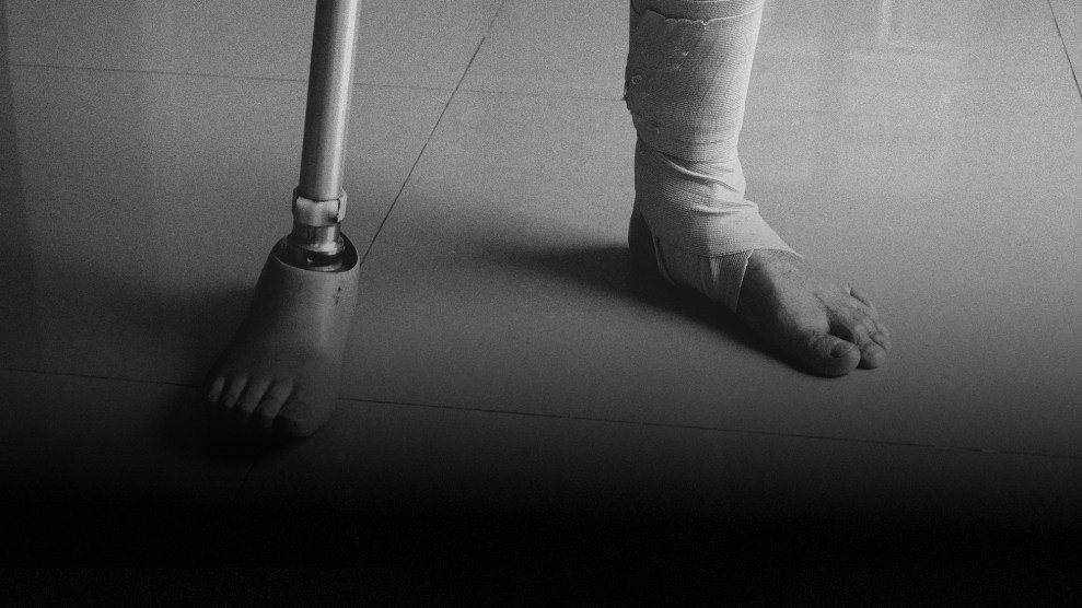 Close-up of a man's feet: one foot is bandaged and the other is a prosthetic limb. A dark gradient encroaches from the bottom of the image, threatening to cover the man's feet.