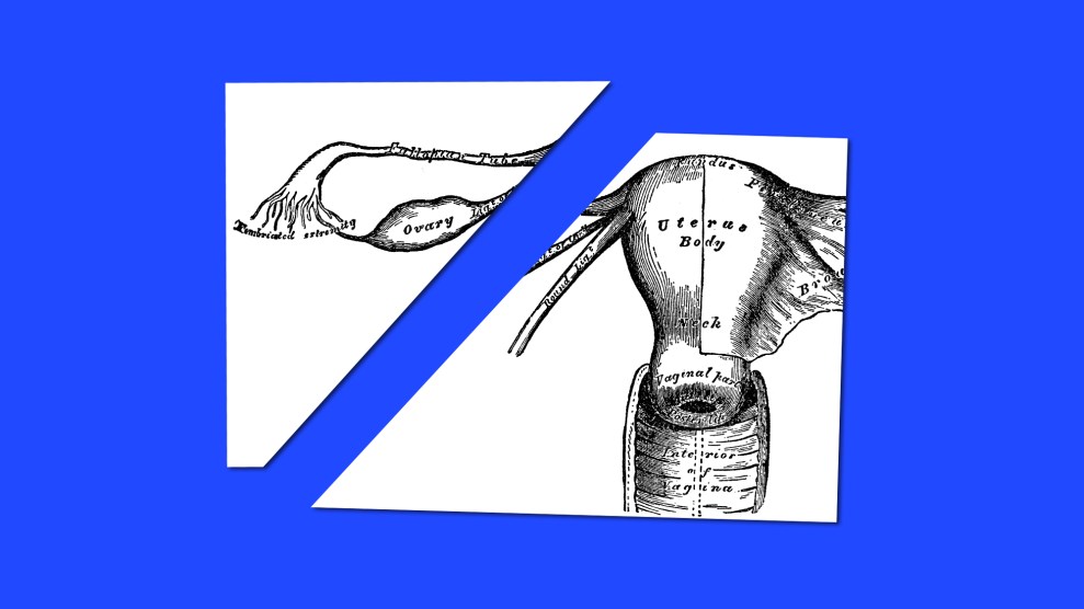 Medical illustration of female reproductive organs; the page has been sliced into two piece, separating the ovaries from the uterus.