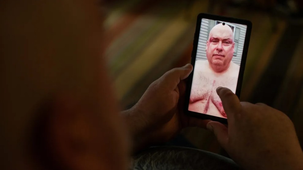 A middle-aged Caucasian man is seen from behind as he looks at a photo of himself on a digital device. In the picture, he’s shirtless and has a noticeable red scar running down the center of his chest.